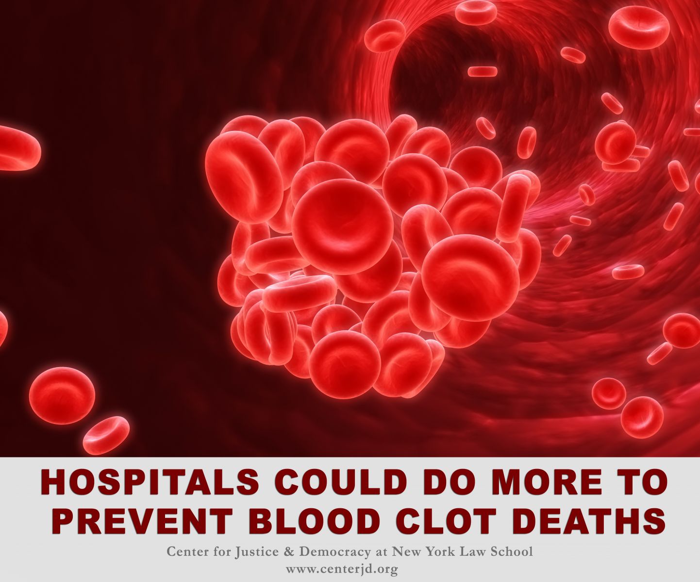 Spotlight Hospitals Could Do More To Prevent Blood Clot Deaths Centerjd